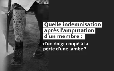 Quelle indemnisation après l’amputation d’un membre : d’un doigt à une jambe ?